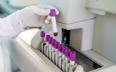 Avertisment pentru toti romanii. Colesterolul care provoaca infarct si nu tine cont de dieta ta