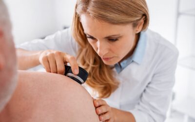 Psoriazisul este recunoscut oficial ca factor de risc independent pentru infarct și AVC