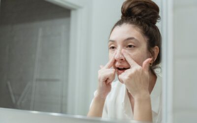 Cum se aleg dischetele exfoliante după ten, de la formule cu 1% acid lactic la cele cu 10% acid glicolic